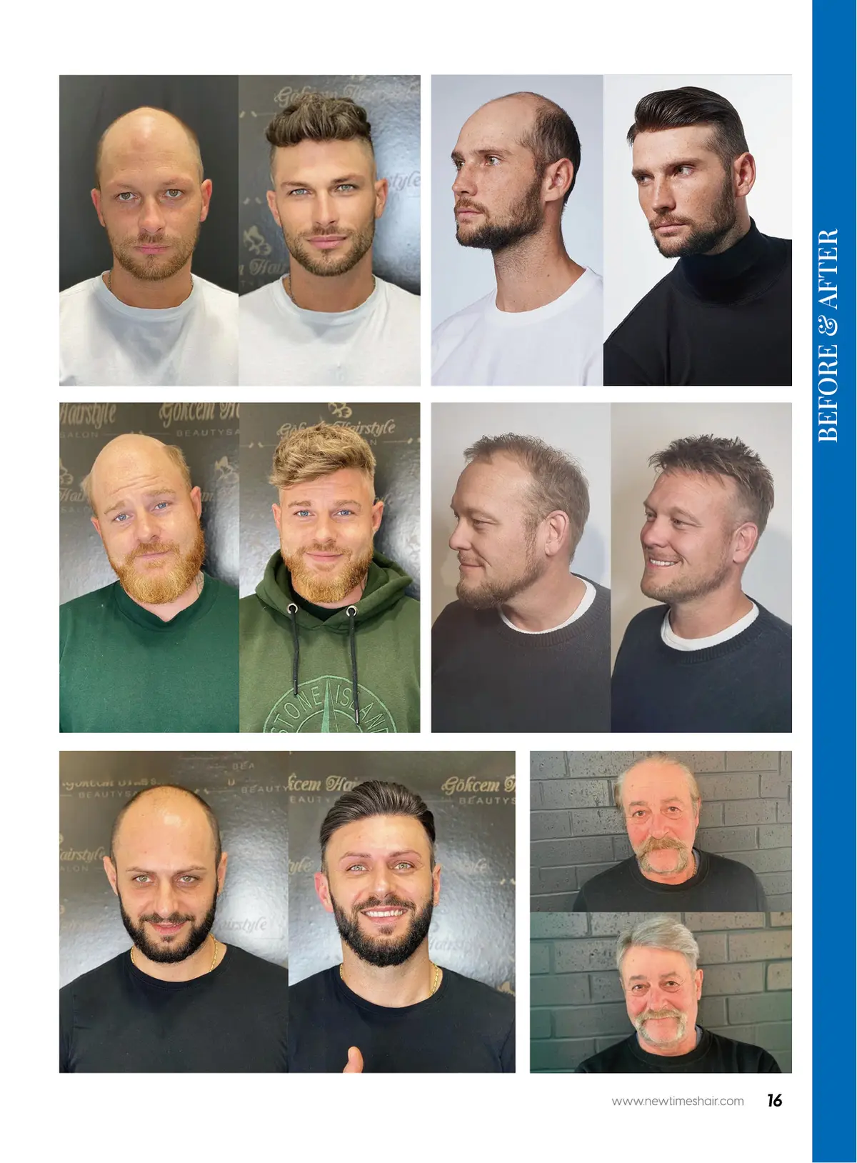 NewTimes Men’s Hair System Color Ring With 99 Colors (Loaner) - Image 6